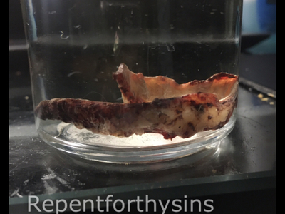 Flesh removed from my body