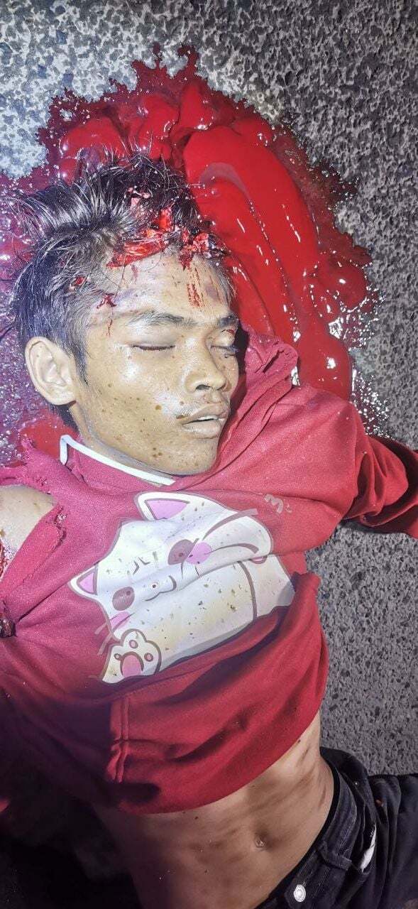 Teen on a Motorbike Collided with an Electric Tricycle