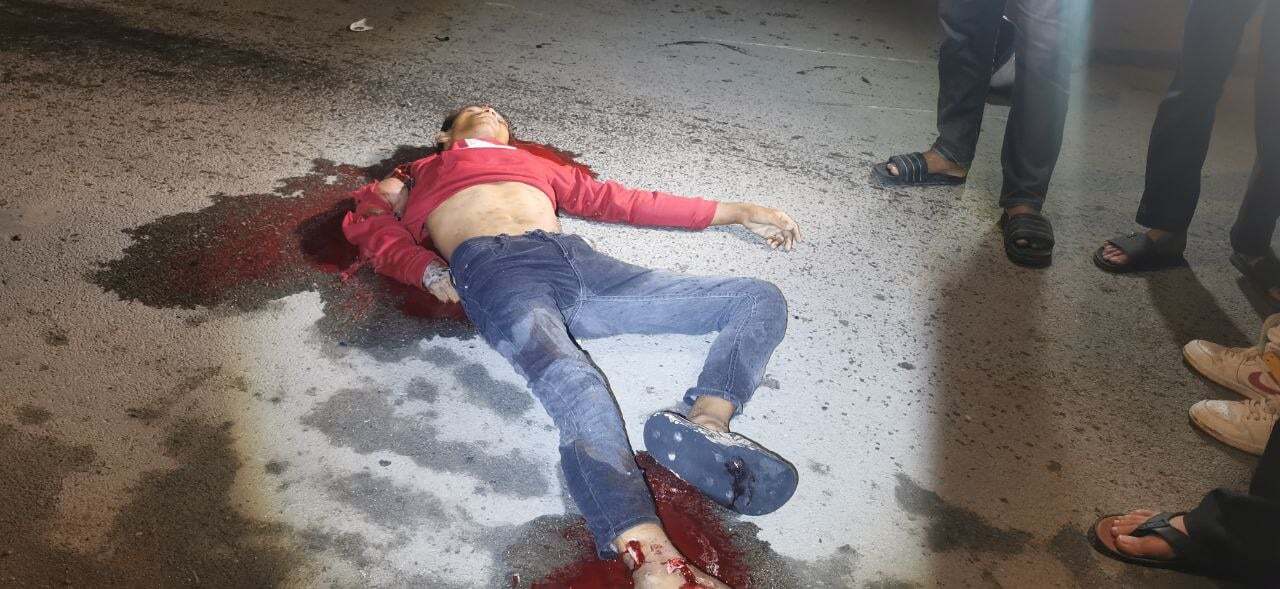 Teen on a Motorbike Collided with an Electric Tricycle