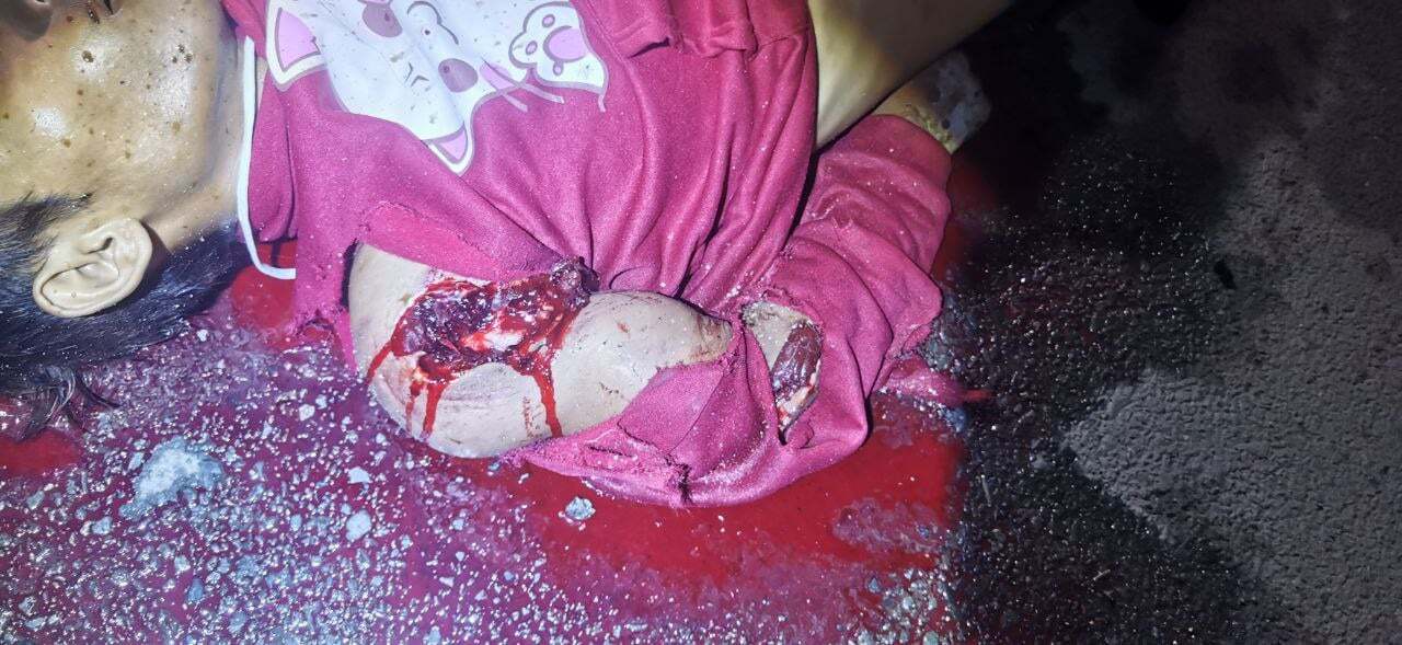 Teen on a Motorbike Collided with an Electric Tricycle