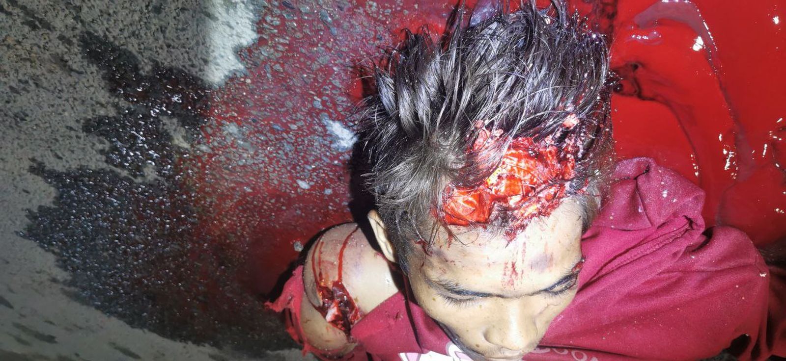 Teen on a Motorbike Collided with an Electric Tricycle