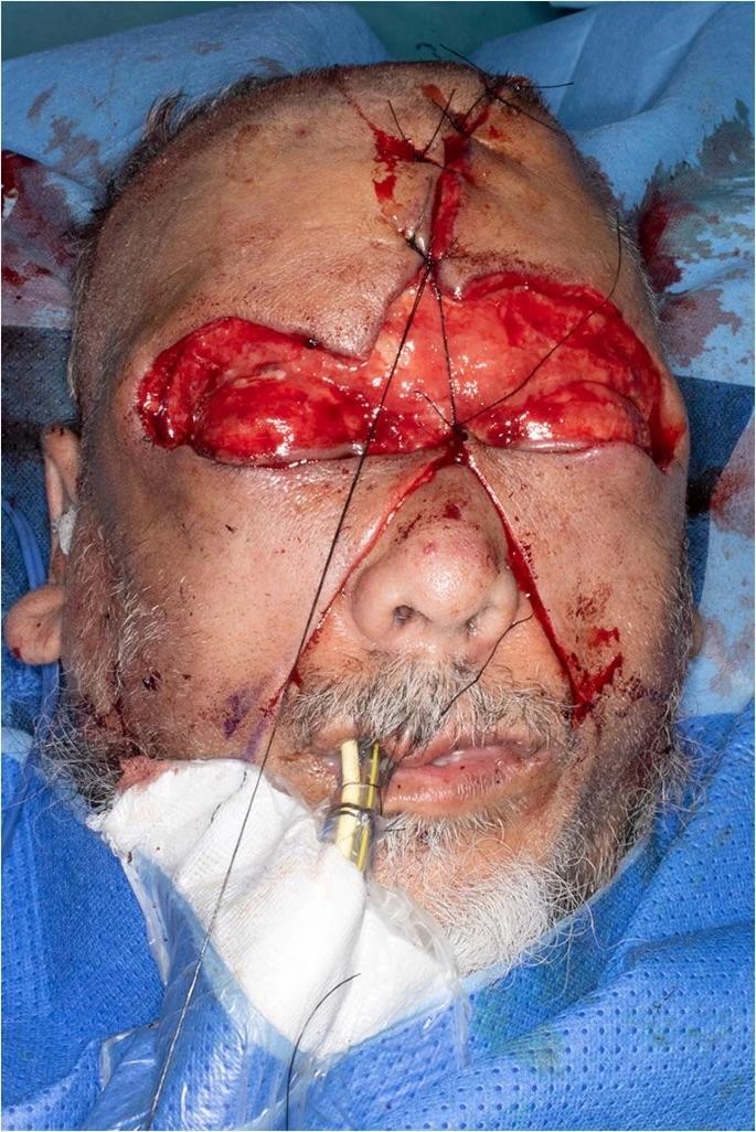 Man attacked with a plank