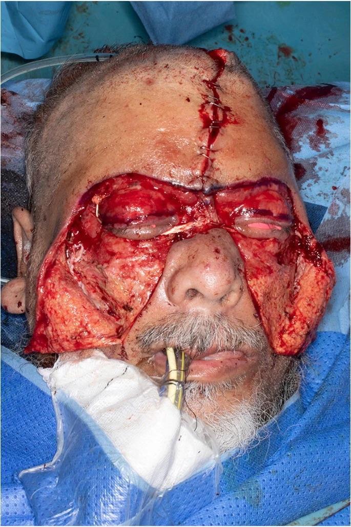 Man attacked with a plank