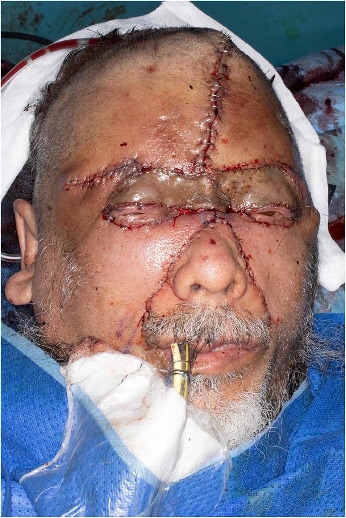 Man attacked with a plank