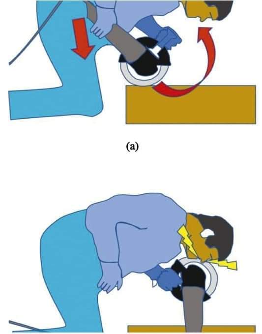 Angle Grinder Accident