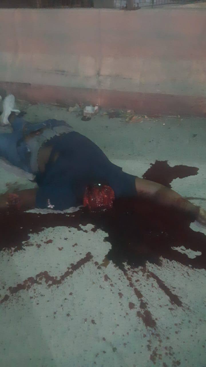 Brazil- Car Accident Resulting In decapitation.