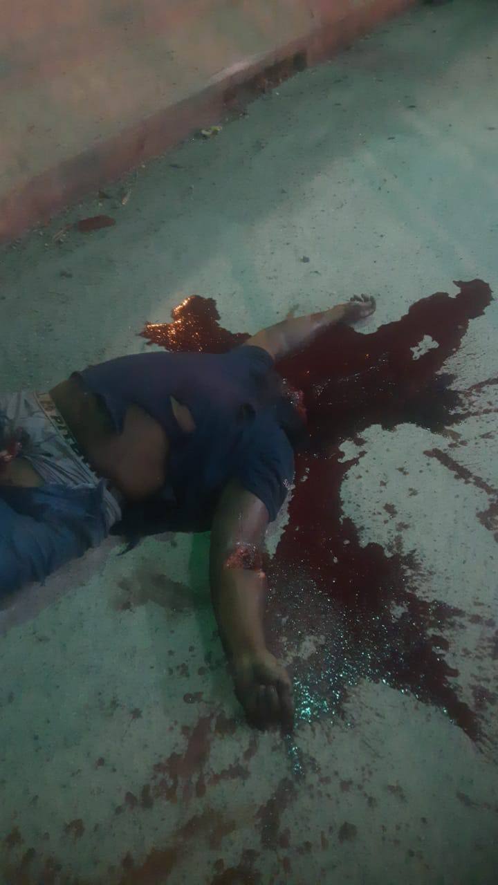 Brazil- Car Accident Resulting In decapitation.