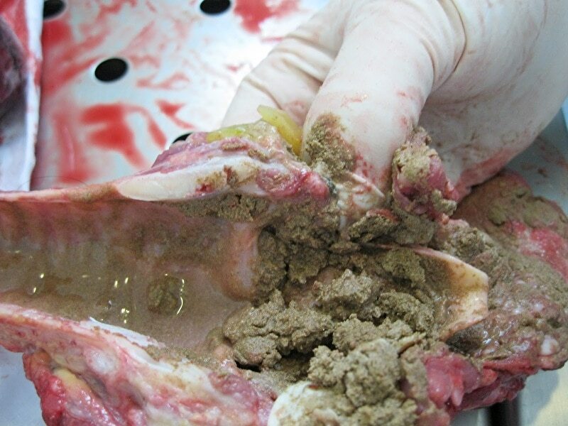 Autopsy of Man Who Suffocated in a Ditch