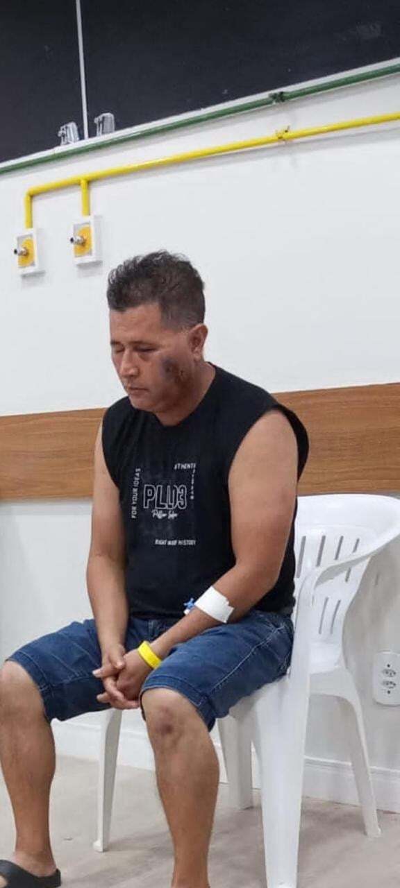 Brazil- Naldo suffered from a necrotizing skin condition died at 30.