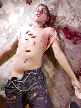 Man was shot and stabbed.