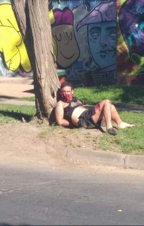 Shot thief, face hanging off.