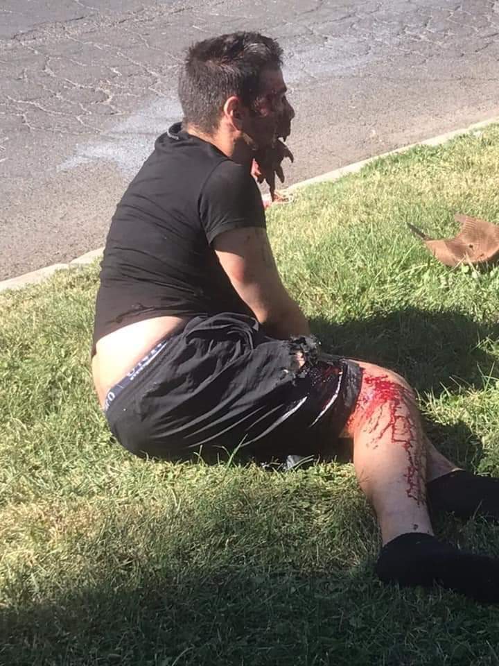 Shot thief, face hanging off.