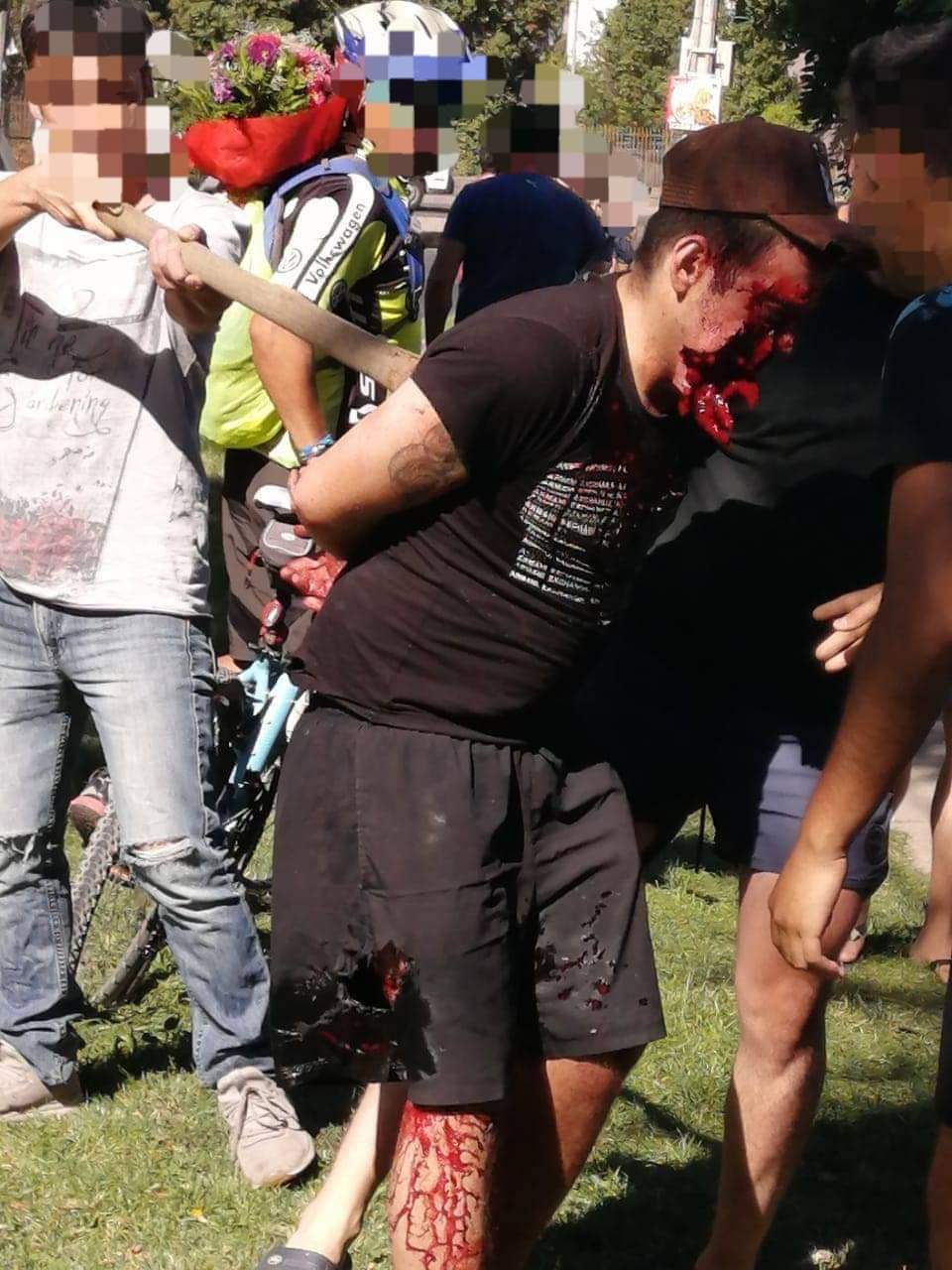 Shot thief, face hanging off.