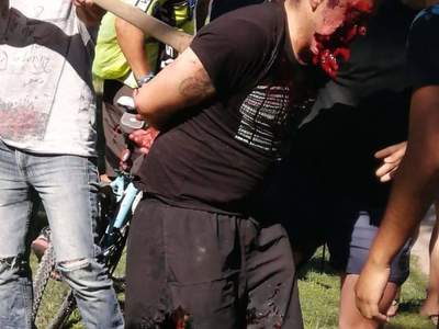 Shot thief, face hanging off.