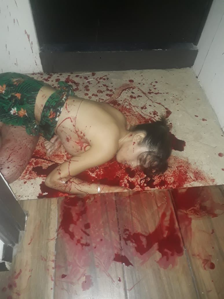 Venezuelan Escort Killed In Mexican Motel Room