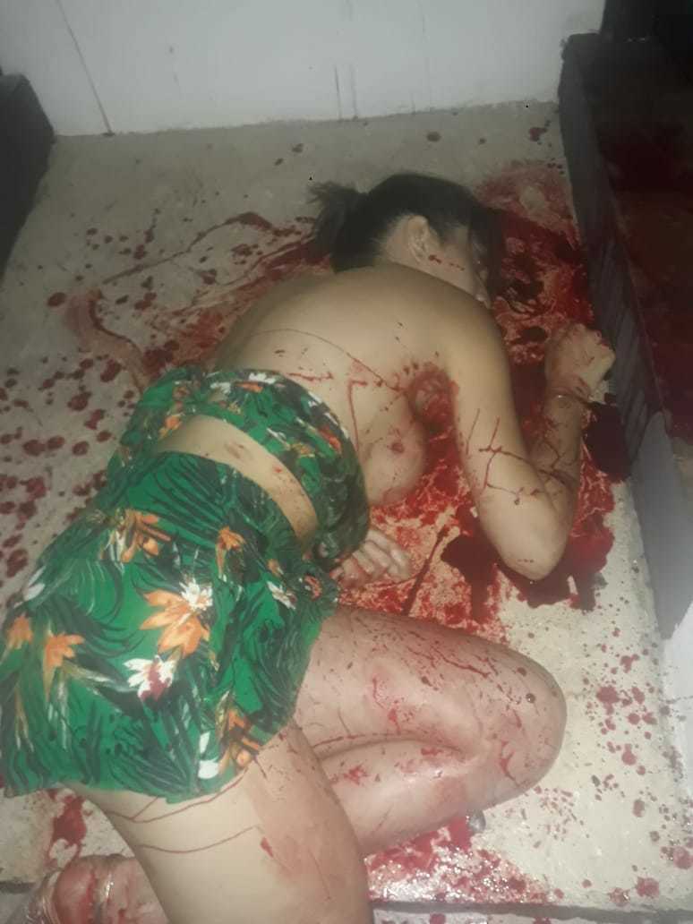 Venezuelan Escort Killed In Mexican Motel Room