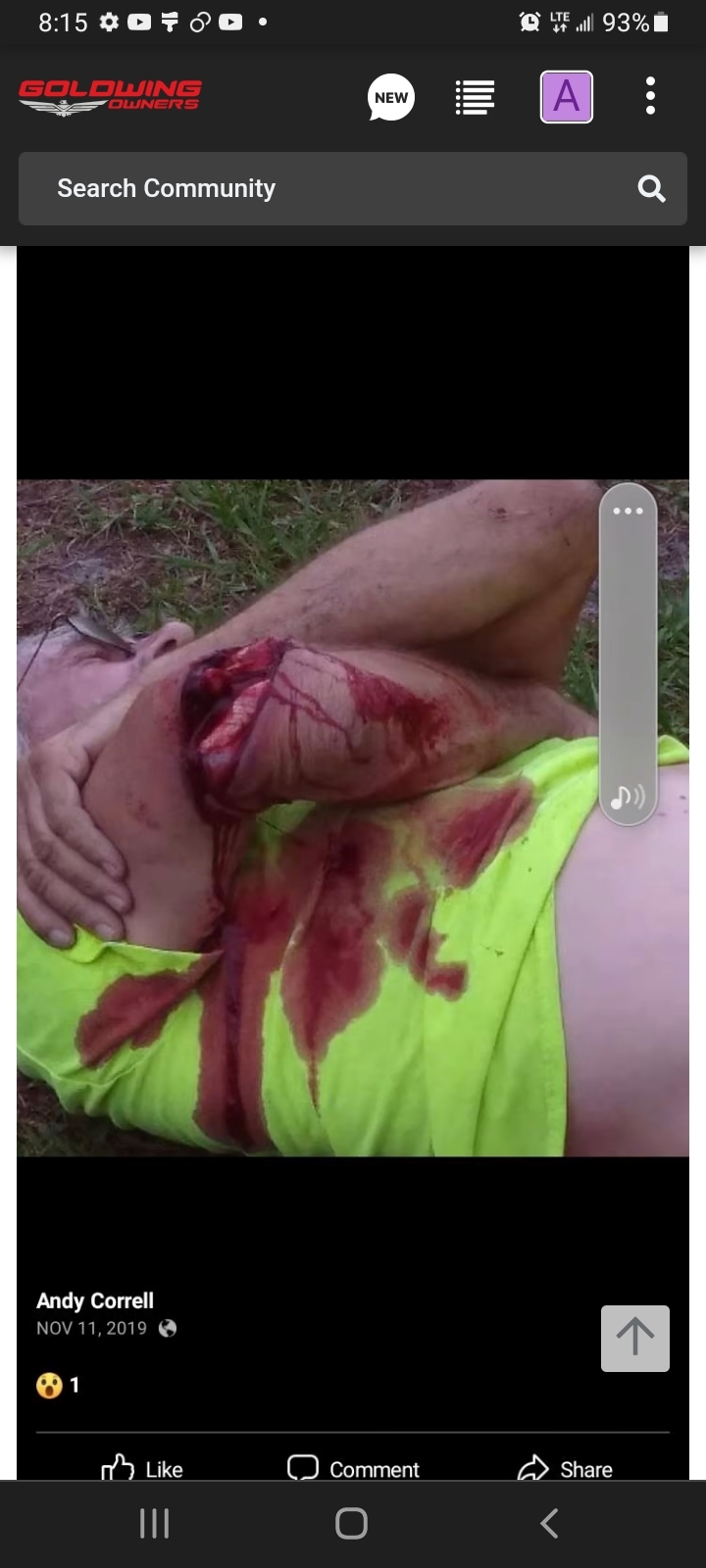 Arm slashed open by model helicopter (image only).