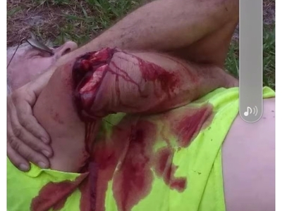 Arm slashed open by model helicopter (image only).