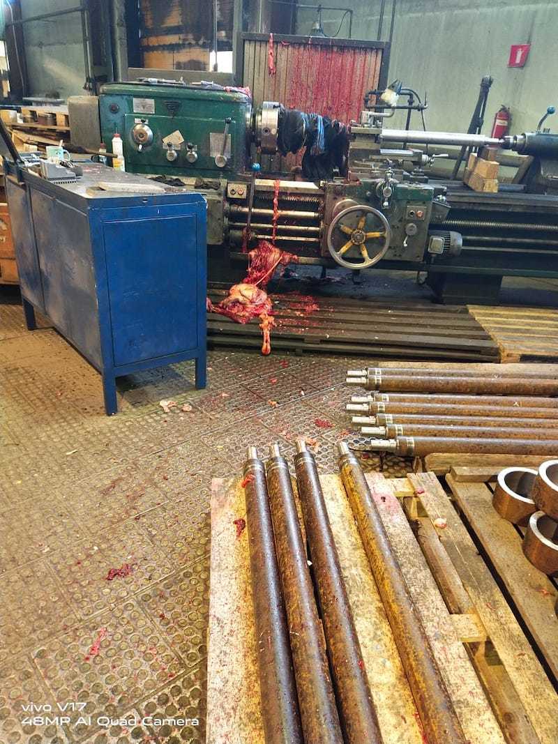 Aftermath pictures of man pulled into lathe