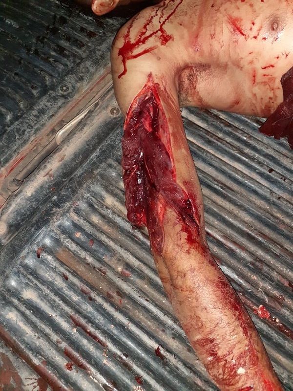 Three different crime scenes (pictures)