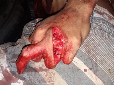 Three different crime scenes (pictures)