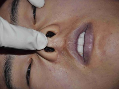 Autposy: Young asian female examined