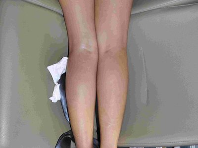 Autposy: Young asian female examined