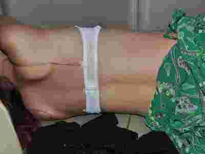 Autposy: Young asian female examined