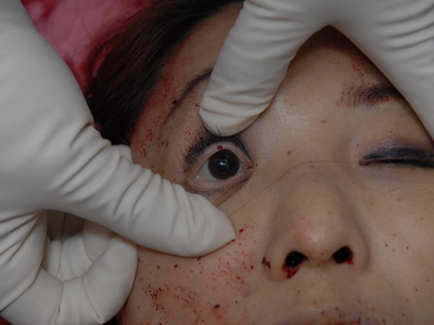 Prostitute found dead in room (examined)