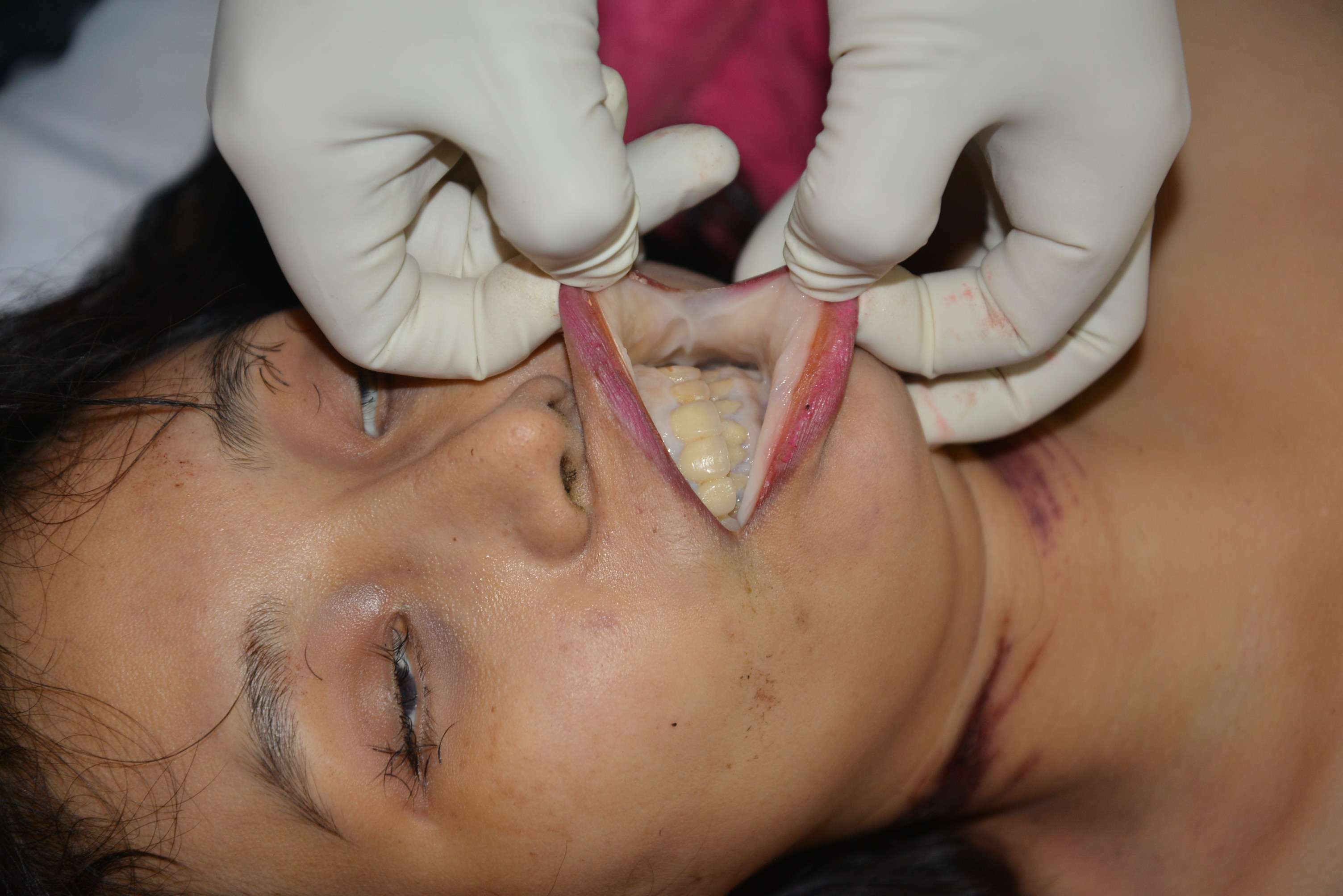 Chinese Mistress Stabbed To Death By Lover.