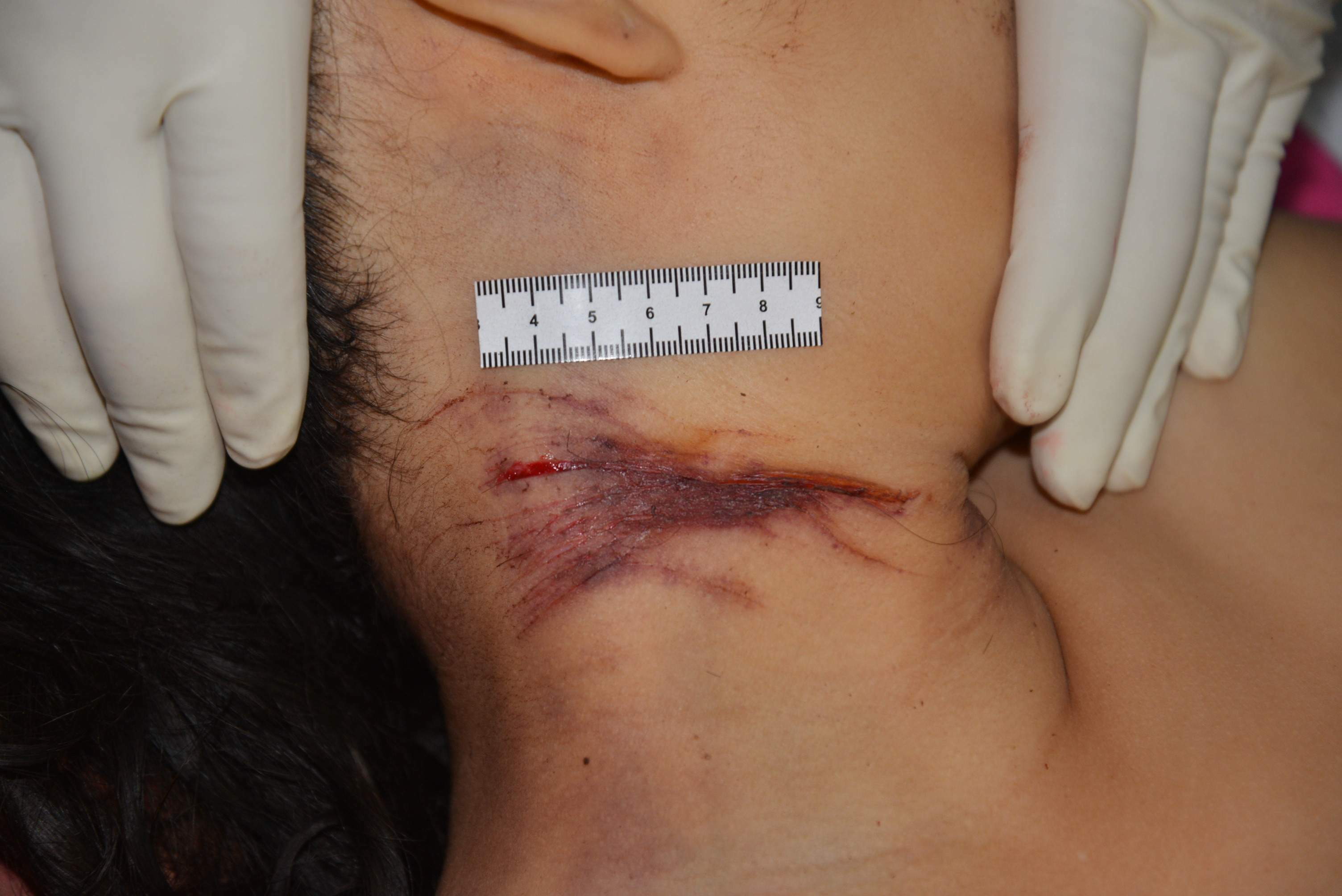 Chinese Mistress Stabbed To Death By Lover.