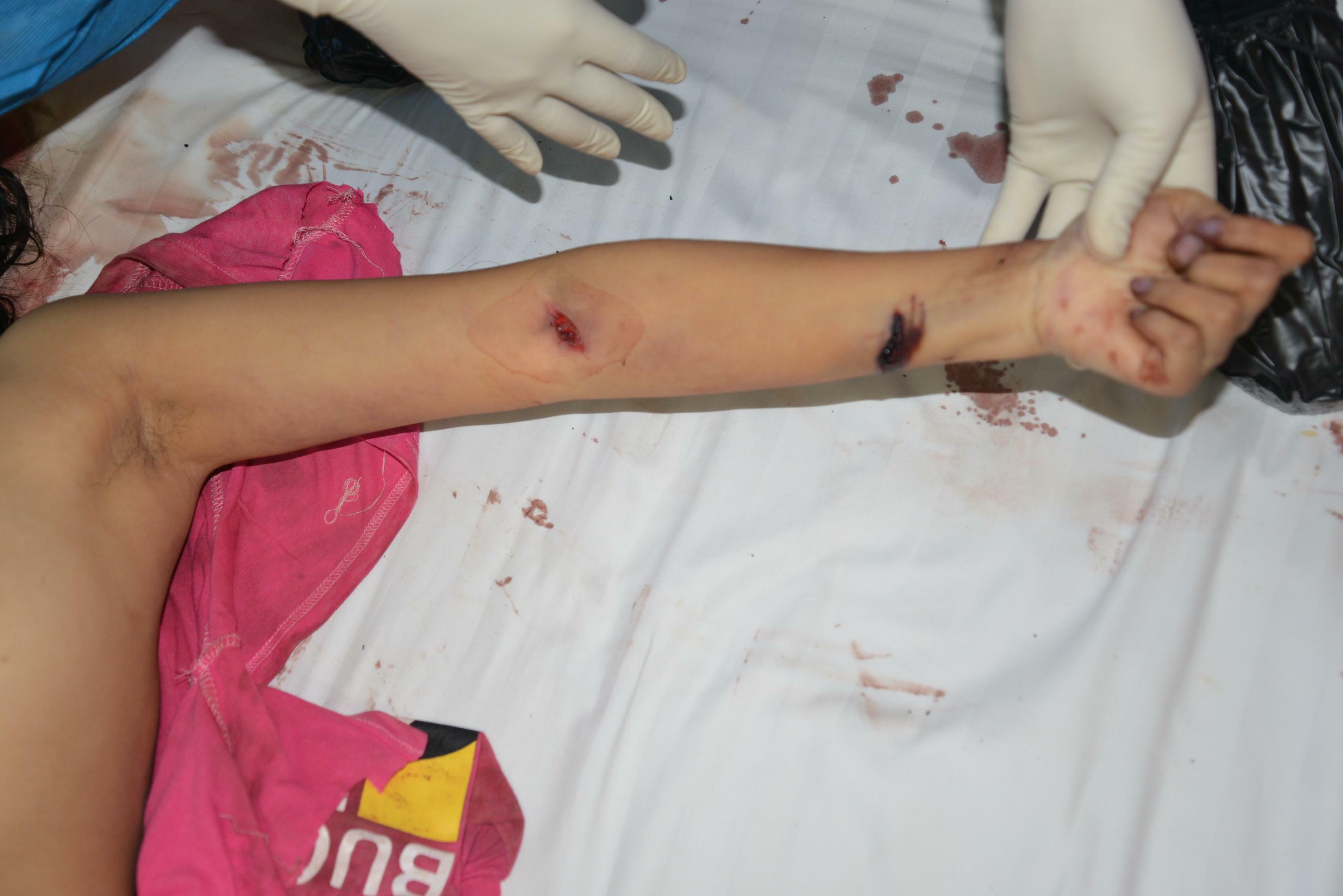 Chinese Mistress Stabbed To Death By Lover.