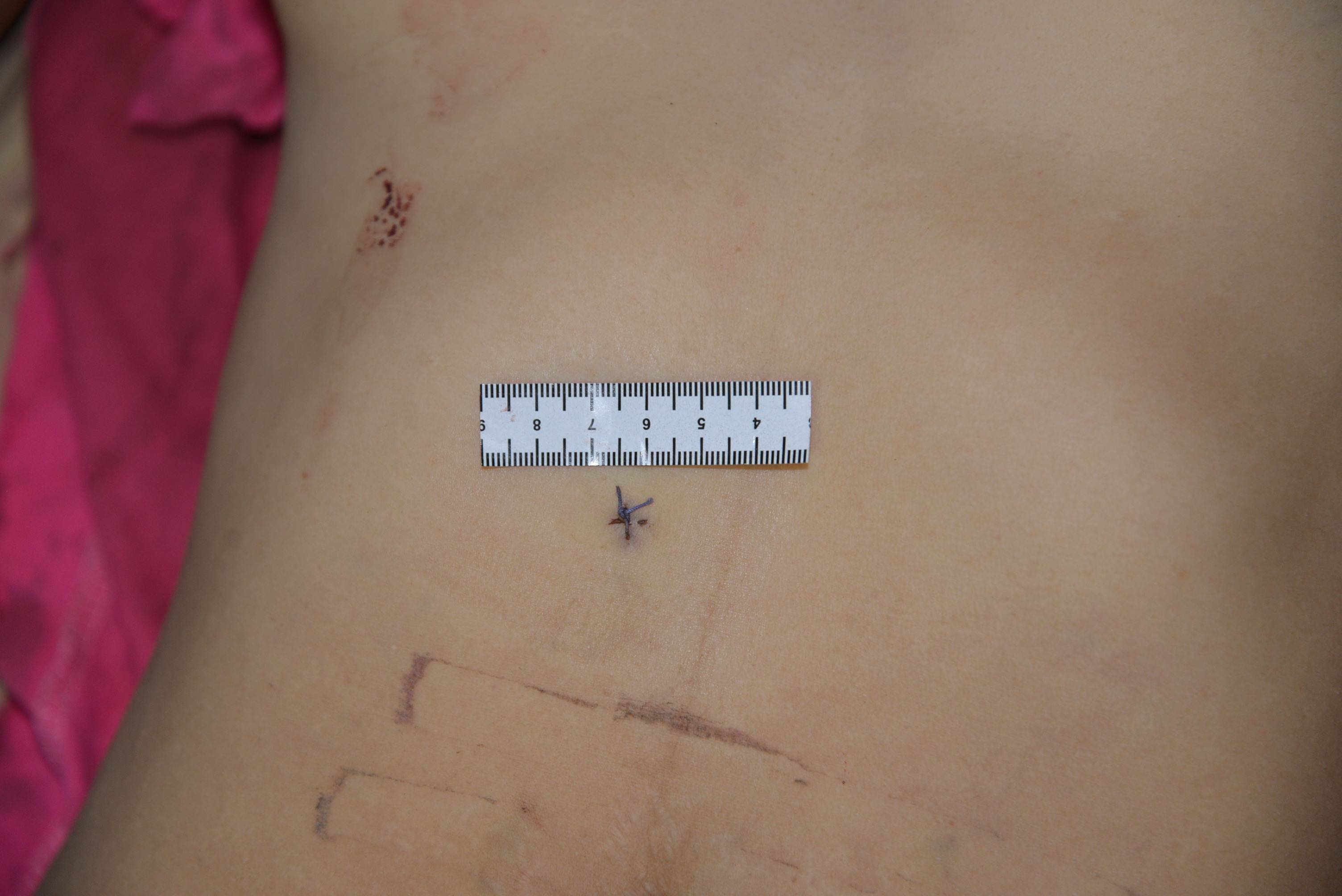 Chinese Mistress Stabbed To Death By Lover.