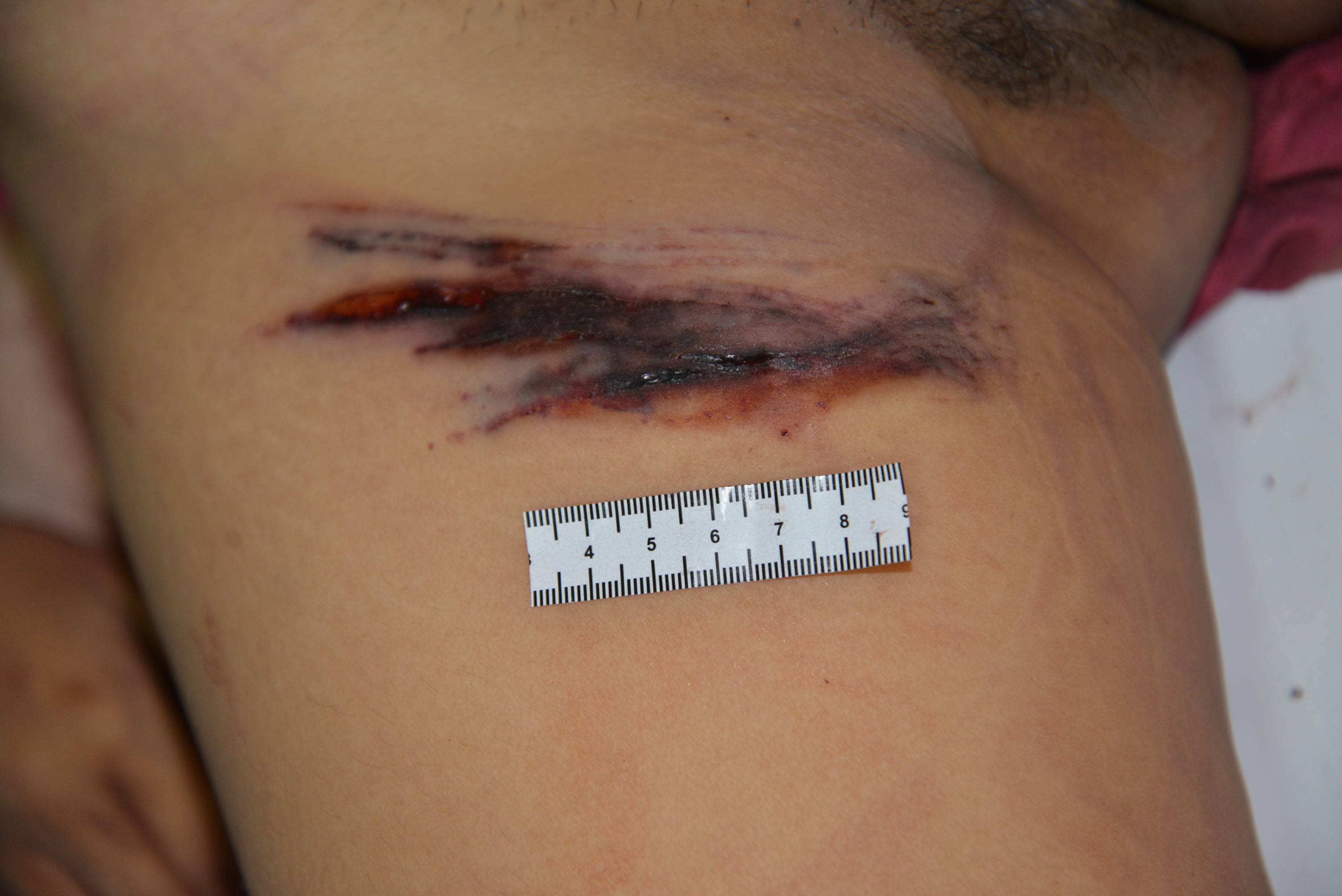 Chinese Mistress Stabbed To Death By Lover.