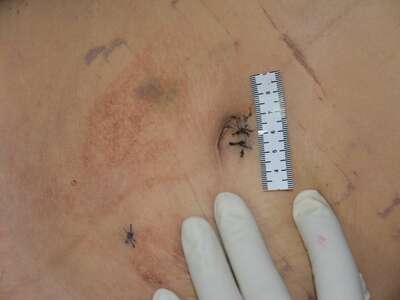 Chinese Mistress Stabbed To Death By Lover.