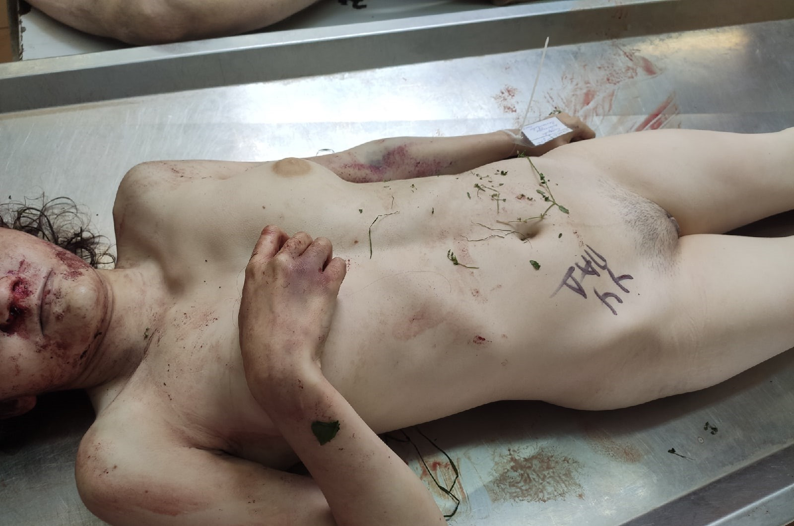 Morgue: woman ready to be dissected