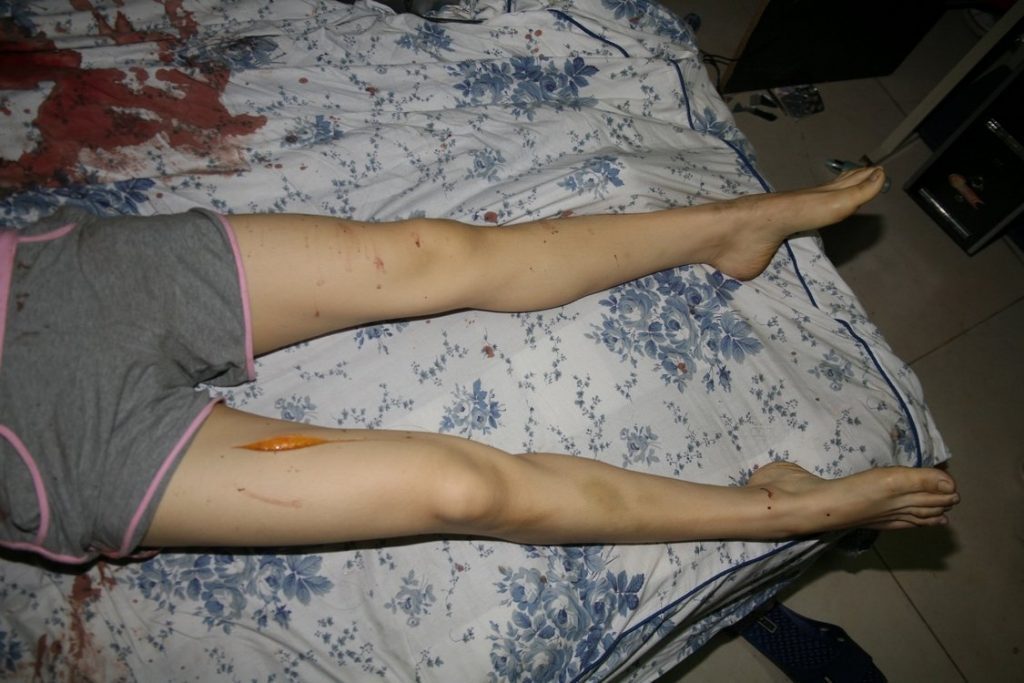 Another Chinese Girl Murdered