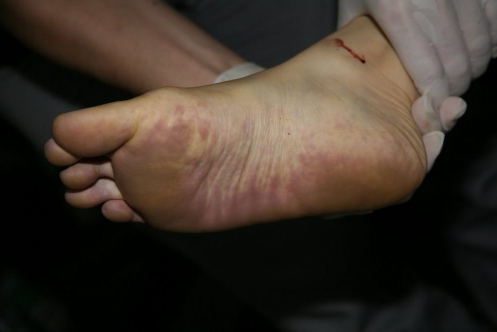 Another Chinese Girl Murdered