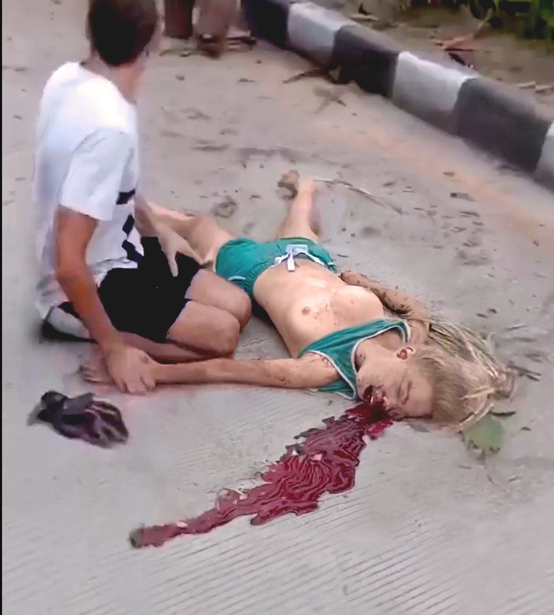 Pretty Girl Dies Tits Out (Before & After)