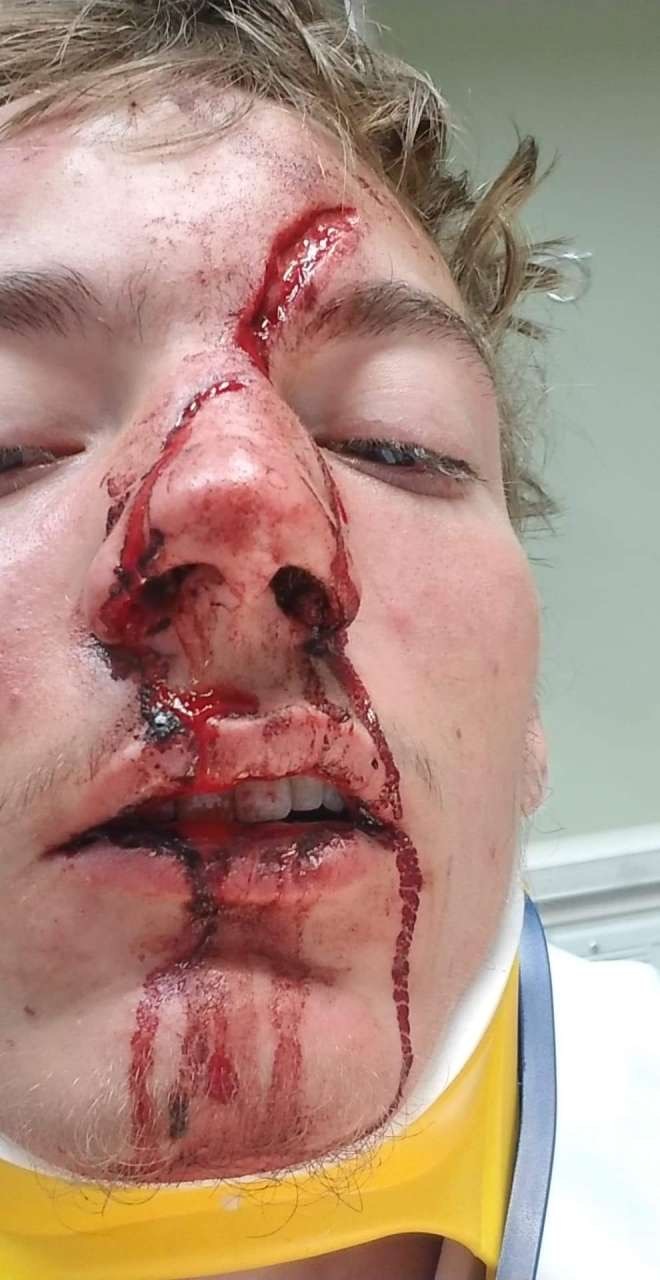 THIS is my Friend After car crash