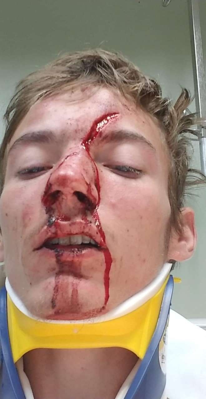 THIS is my Friend After car crash