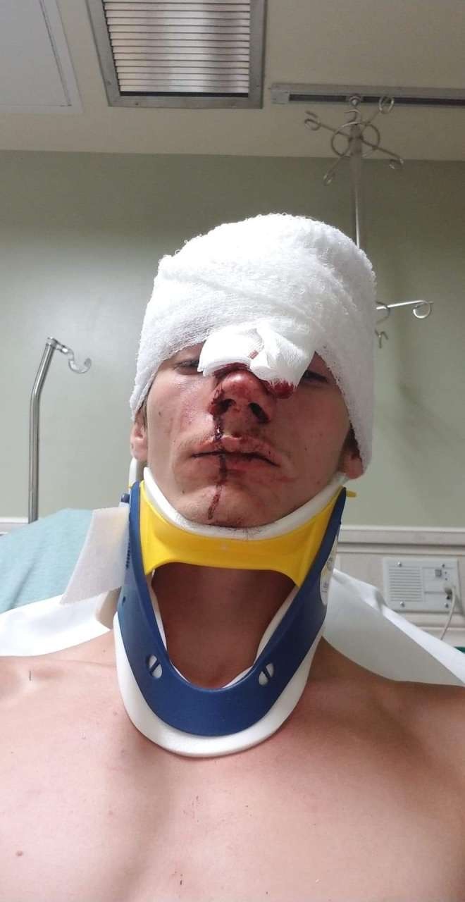 THIS is my Friend After car crash