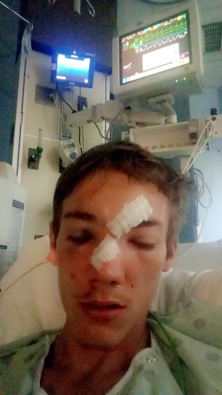 THIS is my Friend After car crash