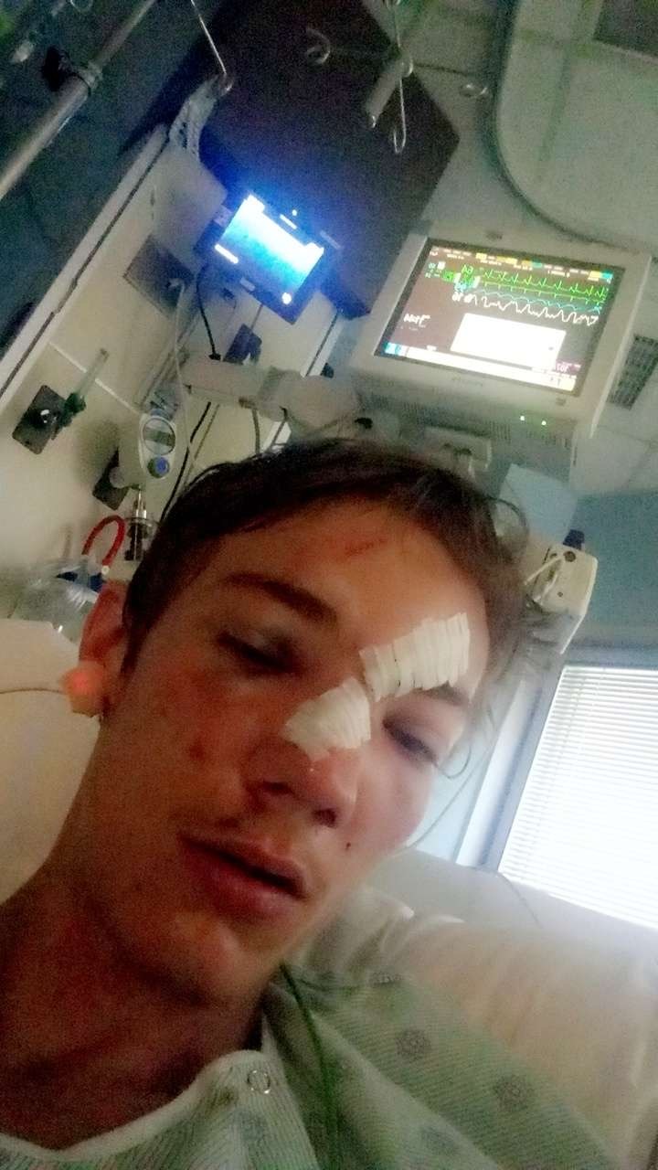 THIS is my Friend After car crash