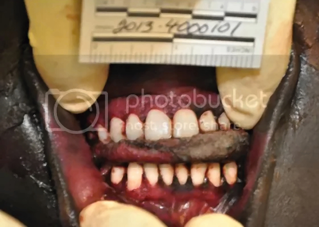 Was it murder or an accident?