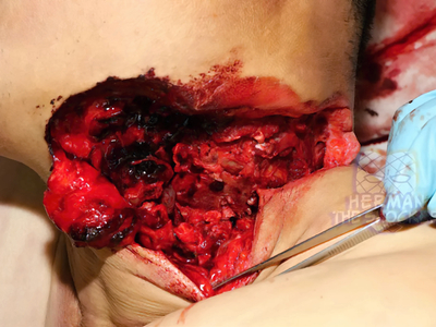 Man Commits Suicide By Cutting His Neck With A Cut-Off Saw