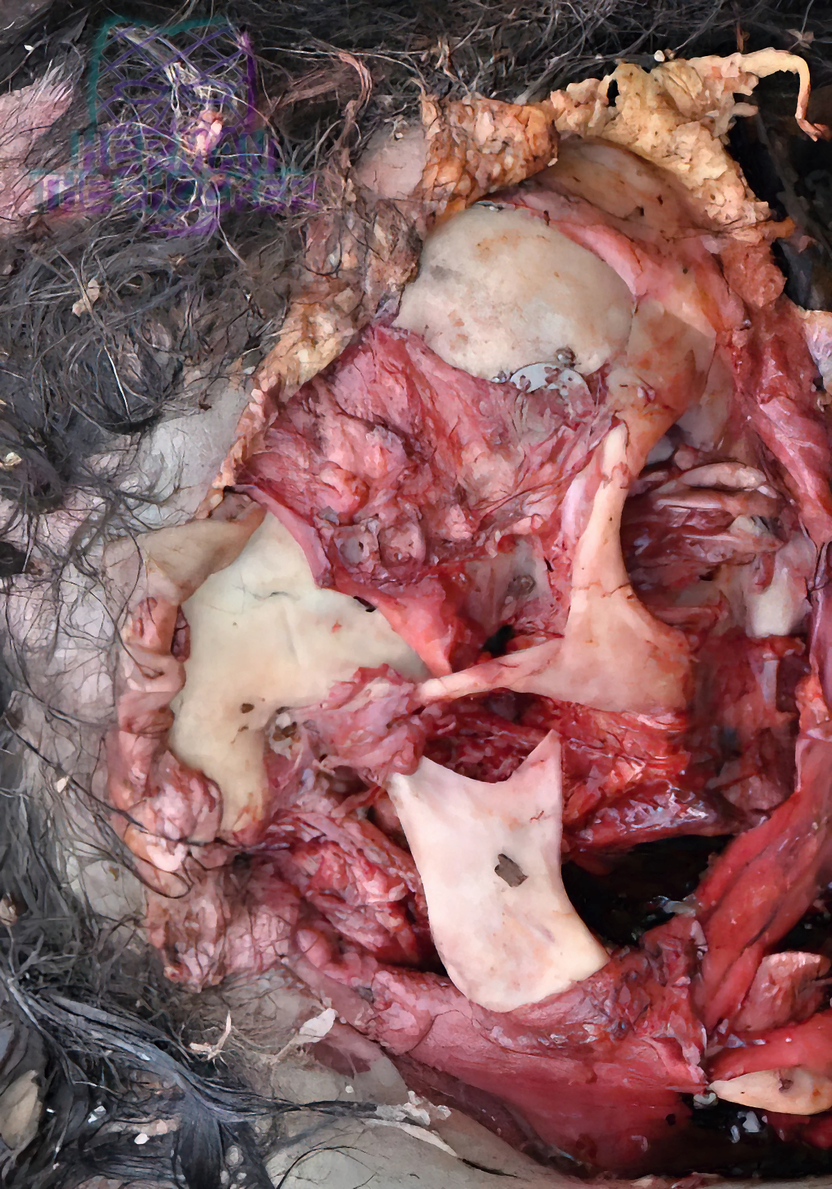 Raccoon Scavenging On A Human Corpse