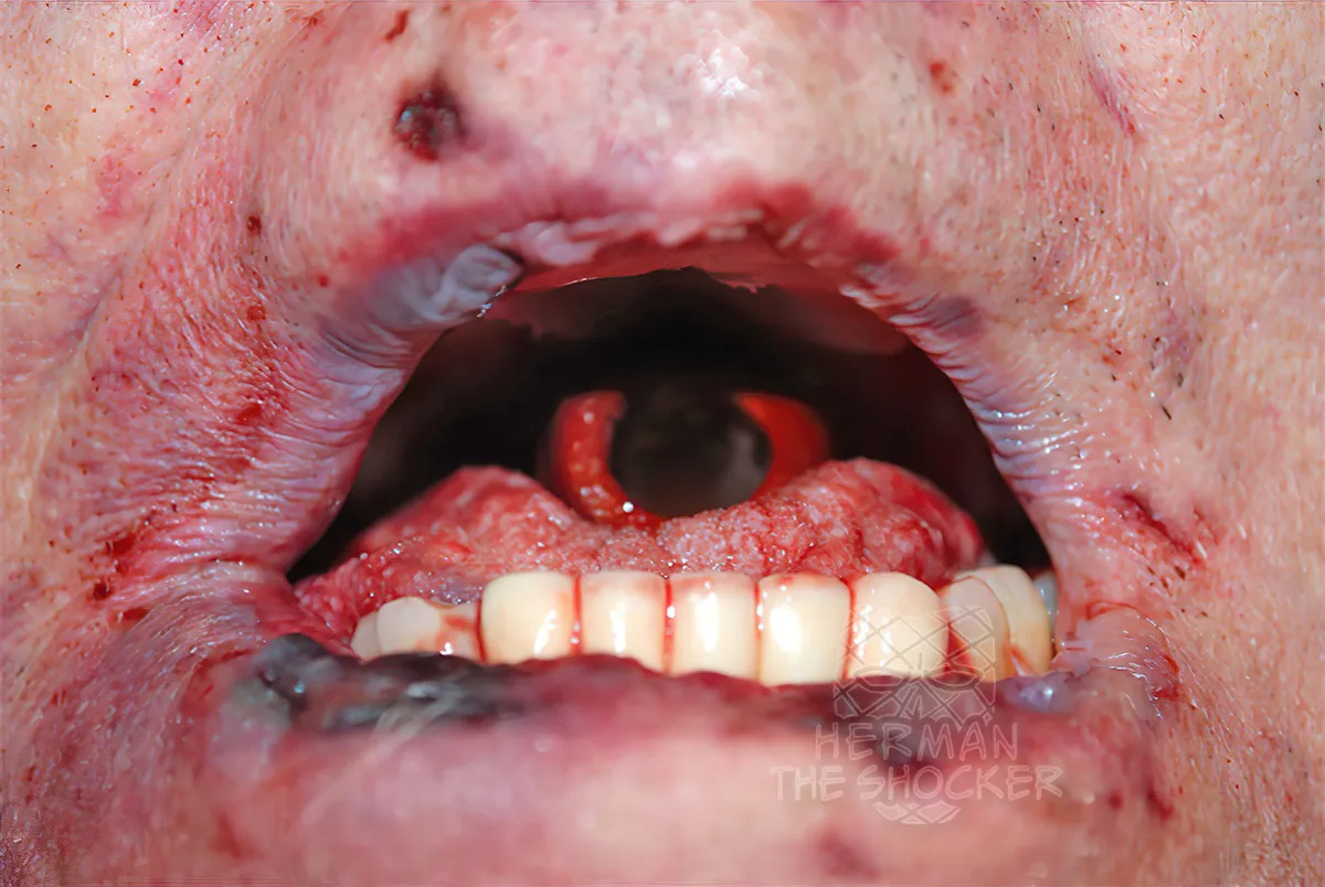 Patricide And Overkill