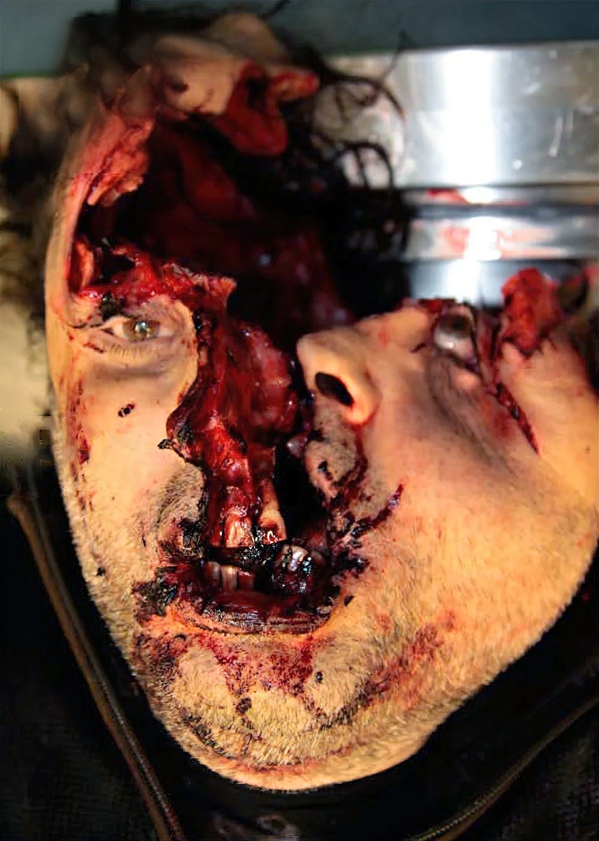 Shotgun Blast To The Head