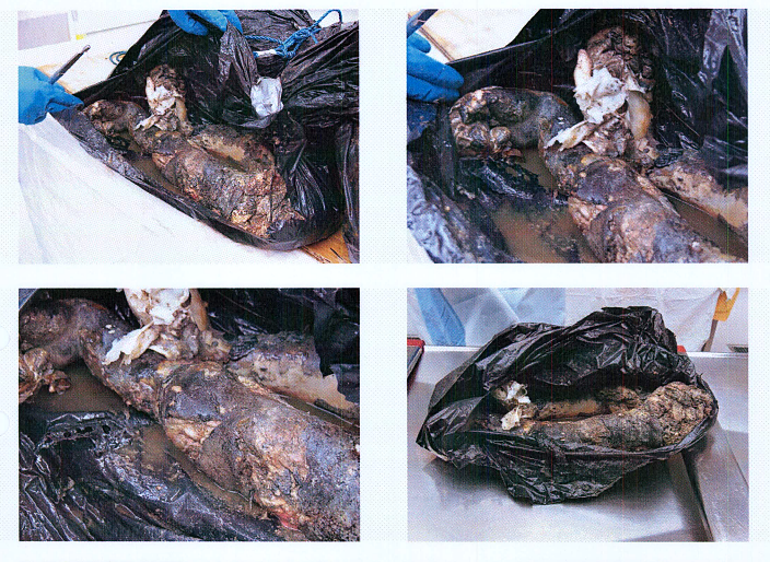 Autopsy images from Christian Larsson case